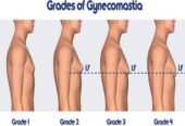 Reclaim Your Confidence with Gynecomastia Surgery in Delhi