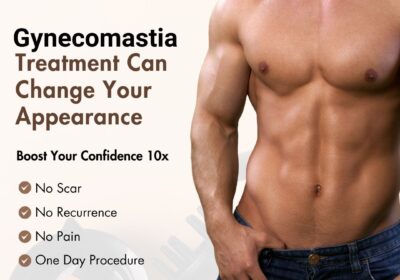 Gynecomastia-1