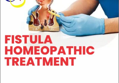 Fistula-homeopathic-treatment-2
