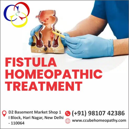 Comprehensive Guide to Fistula Homeopathic Treatment Delhi