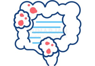 07_Colon-Cancer-Profile-Pic