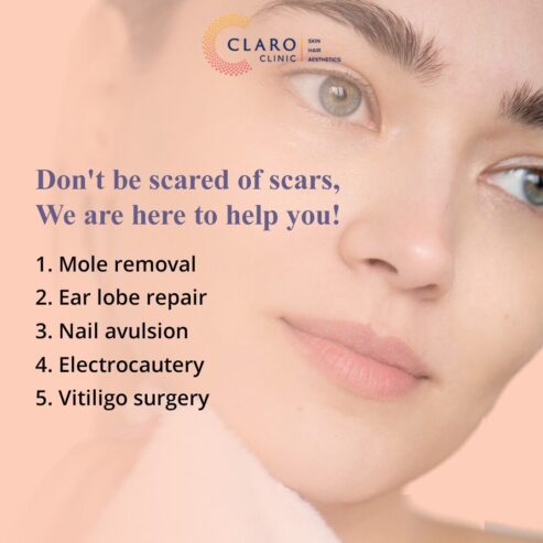 Top Skin Specialist in Borivali West | Claro Clinic